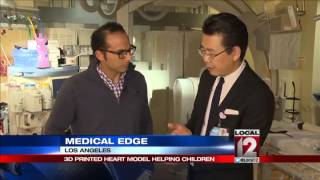 3D printed heart model helping children