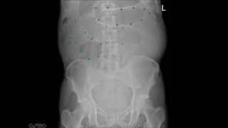 The Neglected Abdominal X ray FREE WEBINAR!