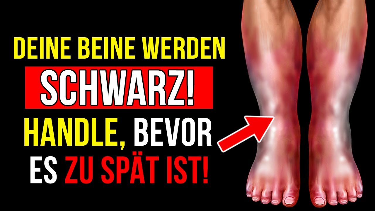 Die 7 Wichtigsten Warnzeichen Für Eine Schlechte Durchblutung Der Beine - Ignorieren Sie sie Nicht!