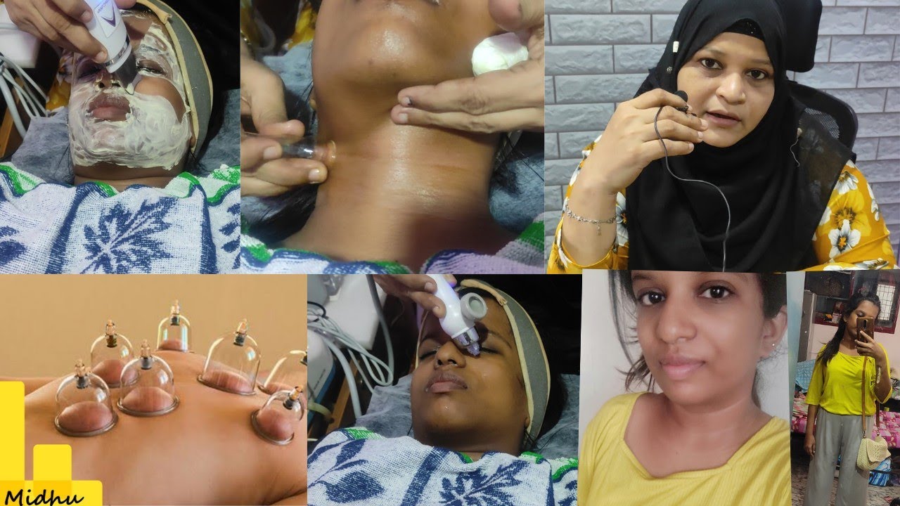 Cupping therapy now at Chennai😱with low price😅my experience about cupping therapy😍hydrafacial result