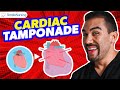 NCLEX Tips for Cardiac Tamponade 🩺