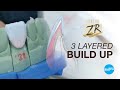 Zirconia Restoration - 3 Layered Build up