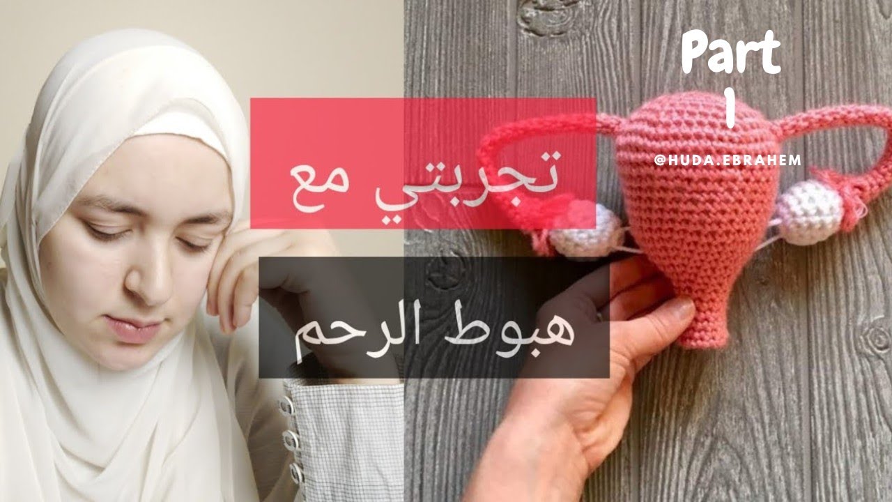 سقوط الرحم في المهبل شرحه بالصور و اسبابه و علاجه #سقوط_الرحم