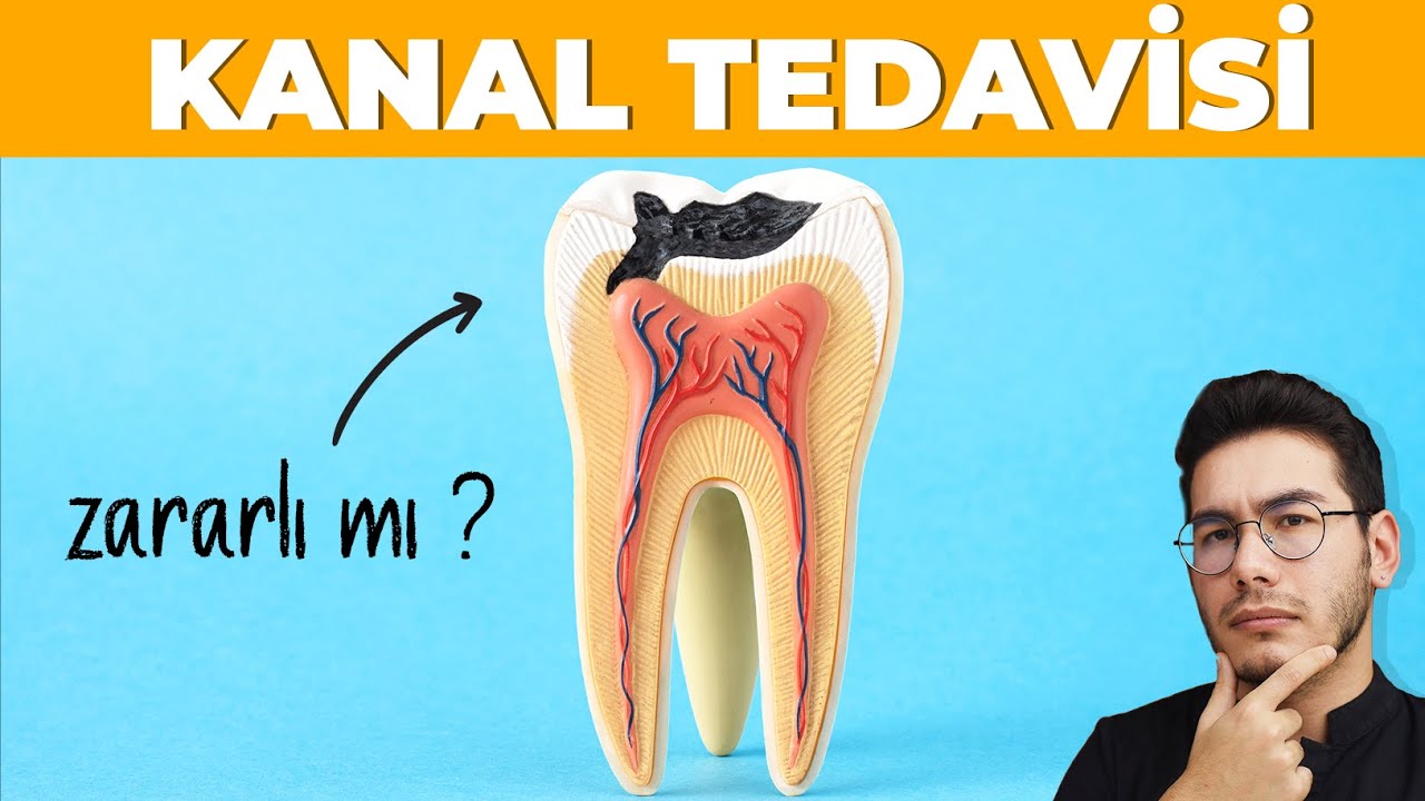 KANAL TEDAVİSİ...En Çok Sorulan 10 Soru ! - Uzm. Dt. Mert Ertekin