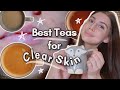 The BEST Teas for GETTING RID OF ACNE and BLOATING! Seriously life savours.