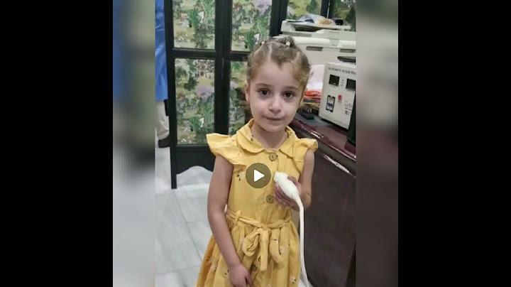 اخيرا أجرت الطفله عمليه في القلب من قبل الفريق  الامريكي .منظمة الرحمة لصحة الطفولة.