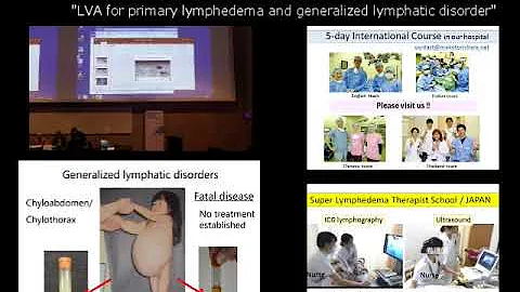 LVA for primary lymphedema and GLD presented by Dr...