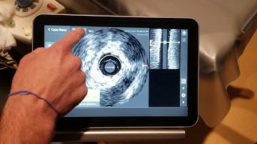 IntraSight Touchscreen Module is Seamless
