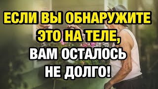 Если на теле пожилого человека появляется это — готовьтесь к худшему…