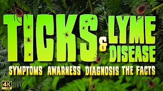 TICKS & LYME DISEASE Symptons - Awareness - Diagnosis - The Facts! 