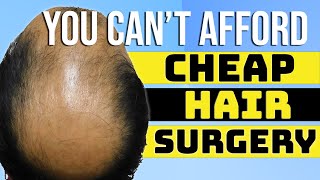 Cheap Hair Transplants are Bad News