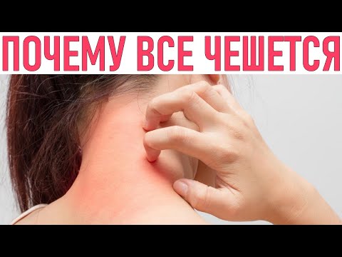 У Меня Все Чешется Что Делать | 10 Неожиданных Причин Почему У Вас Всё Чешется