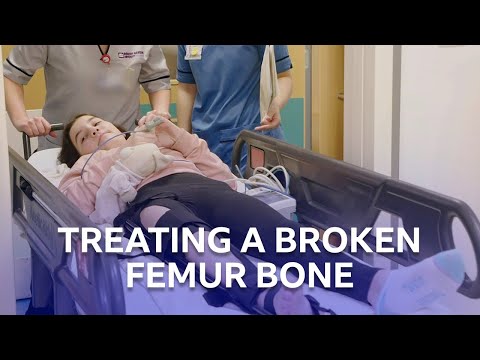 A Broken Femur | The Children&rsquo;s Hospital | BBC Scotland