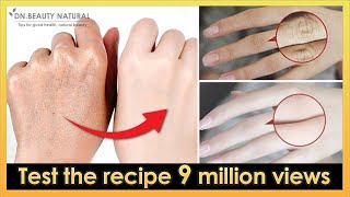 How to make your hands look younger, smoot, fair overnight!  (Test the recipe 9 million views) screenshot 5