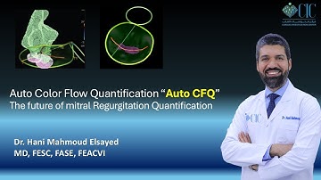 Automated Color Flow Quantification "Auto CFQ"; The future of MR Quantification.