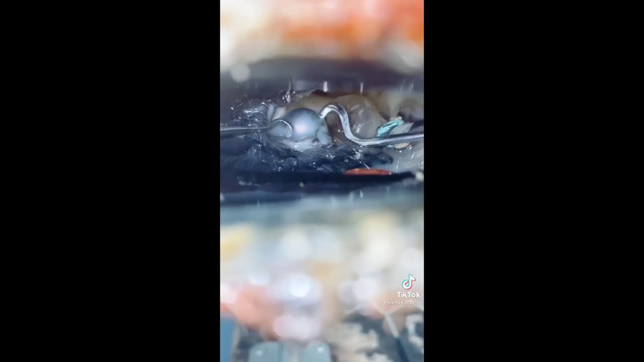 How To Get A Clam To Open Without Killing It