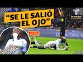 Escalofriante lesión de jugador del Napoli: “se le salió el ojo” | Telemundo Deportes