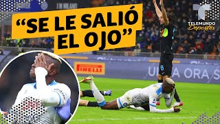 Escalofriante lesión de jugador del Napoli: “se le salió el ojo” | Telemundo Deportes screenshot 3