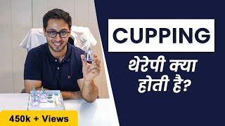 What Is Cupping Therapy | Benefits of Cupping Therapy | Do You Need Cupping Therapy?