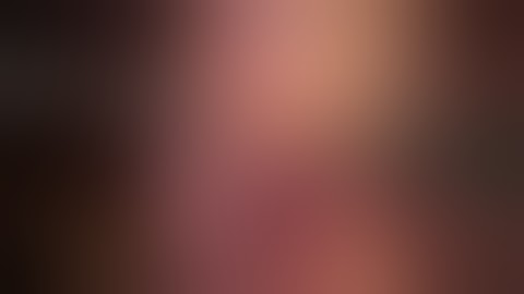 The Difficult Calots: Laparoscopic Cholecystectomy by Dr Vishal Soni