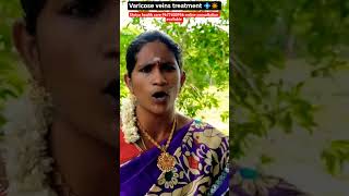 Varicose veins treatment 💠✴️ #shorts #viral #trending #health #varicoseveins #naturopathy #tamil