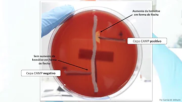 Como é realizada a prova de Camp?