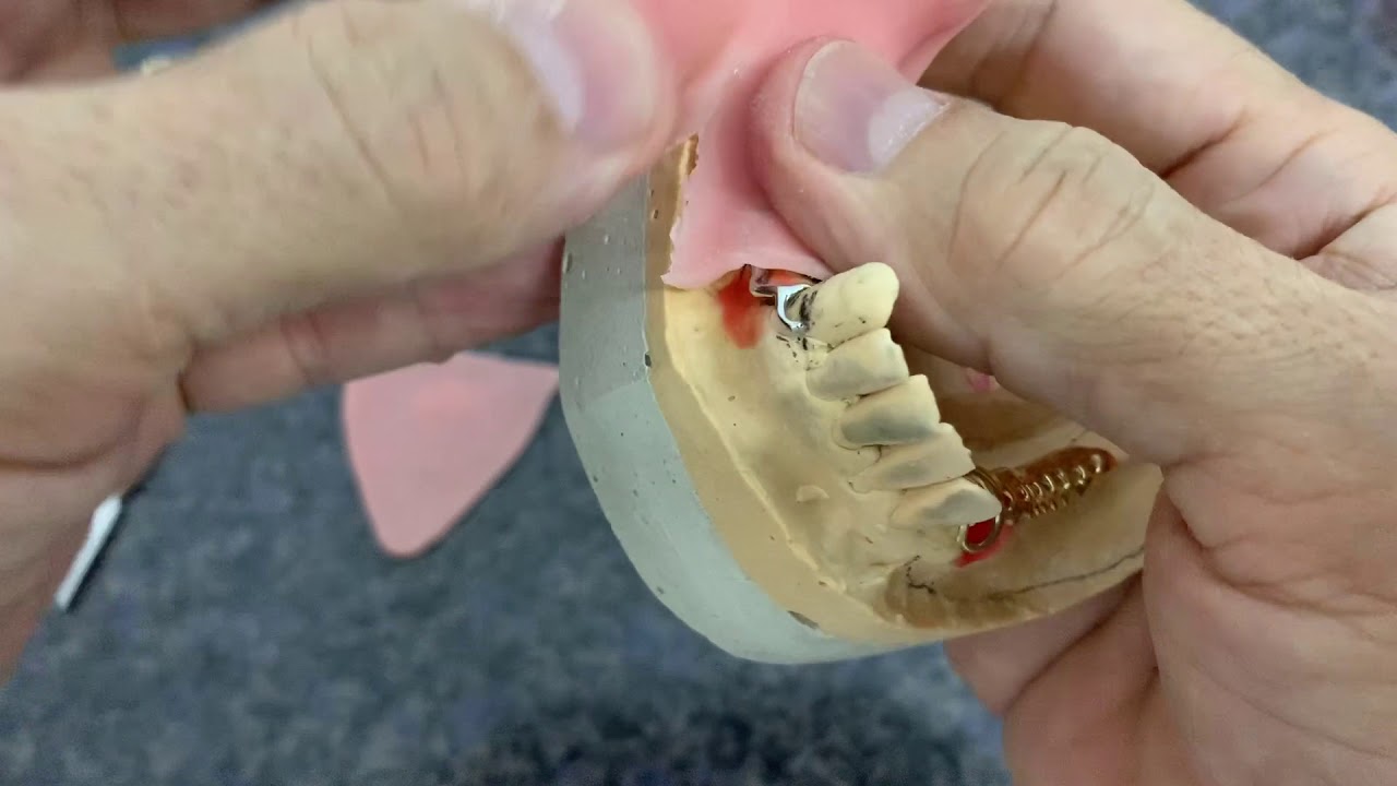 Plano de cera sobre armação de PPR