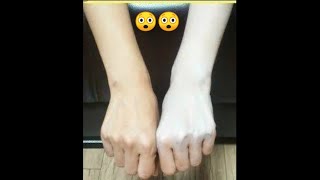 #shorts Hand whitening in 1sec only😲/ #youtubeshorts #shortsyoutube screenshot 4