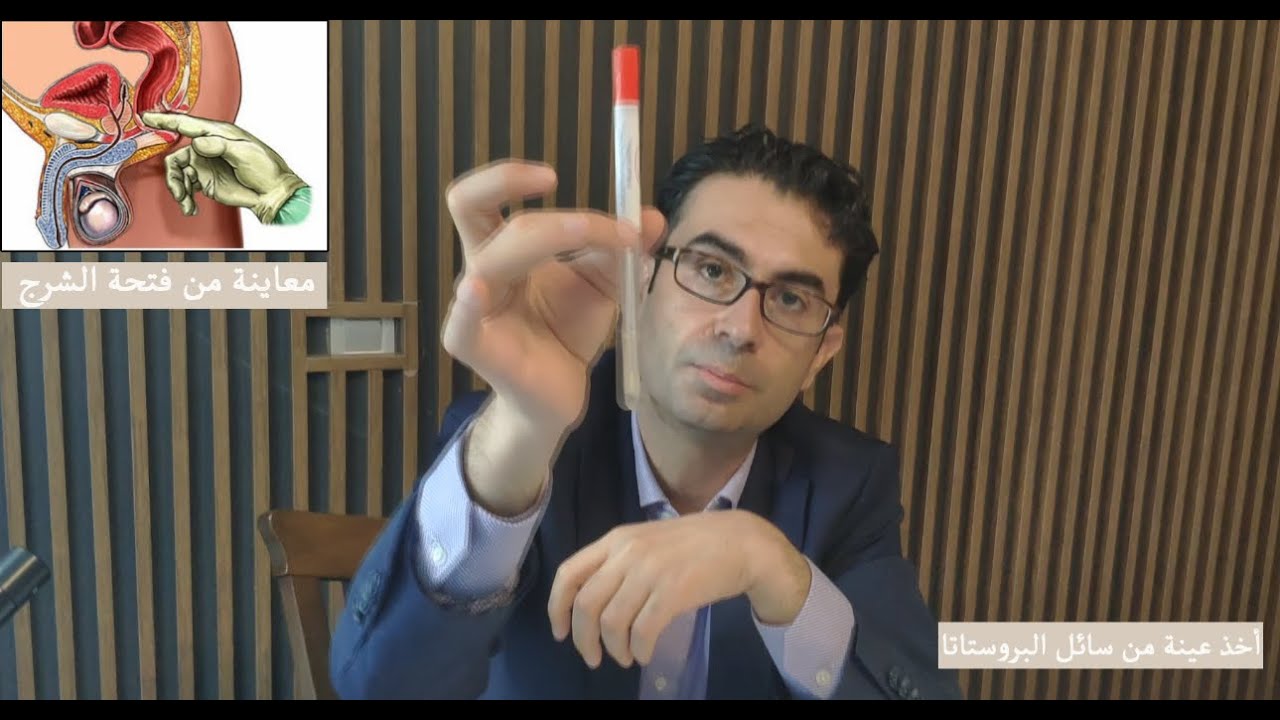 شرح التهاب البروستات بالتفصيل كيفية المعاينة وطريقة العلاج // البرفسور الدكتور محسن بالابان