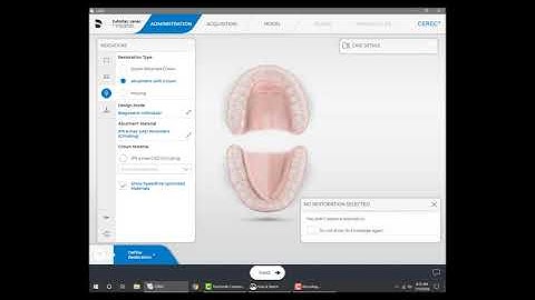CEREC Implant Case Setup