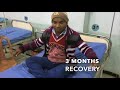 cervical spine surgery - corpectomy and fusion