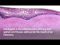 Meningitis outbreak: What is it and what are the symptoms?