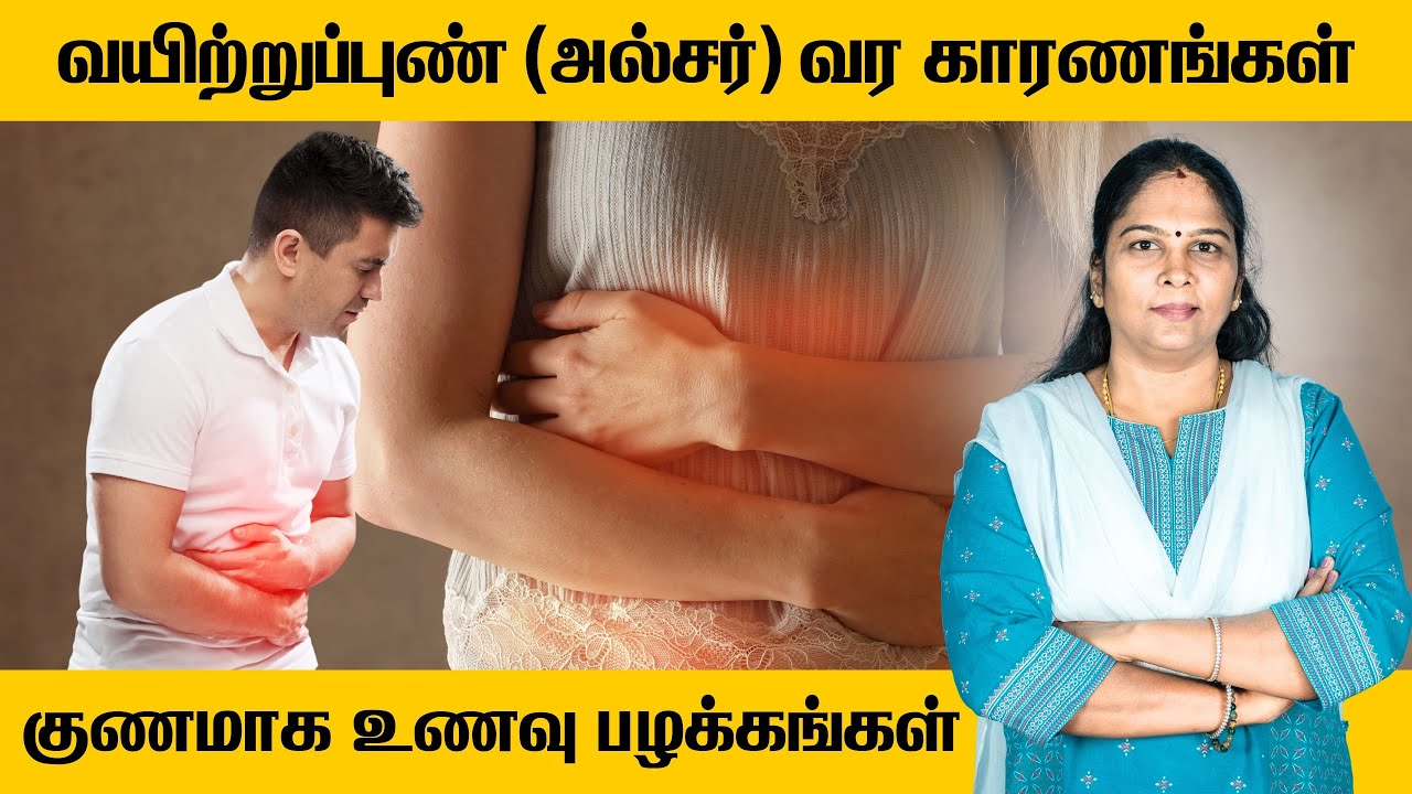 Stomach Ulcer Treatment | Food Habits | வயிற்றுப்புண் அல்சர் வருவதற்கான காரணங்கள் | உணவுப் பழக்கம்