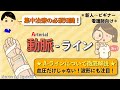 【Aライン徹底解説!】圧波形にも注目して見てみよう!