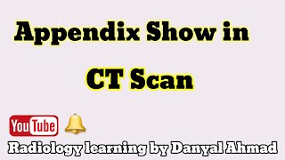 ct scan appendix ct scan normal appendix