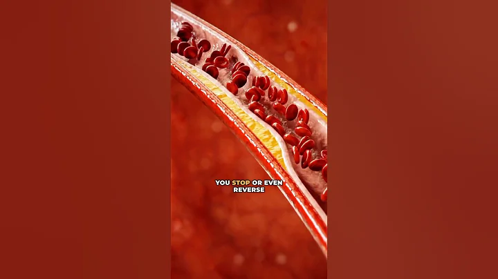 3 Ways To Clean Your Arteries ￼🫀