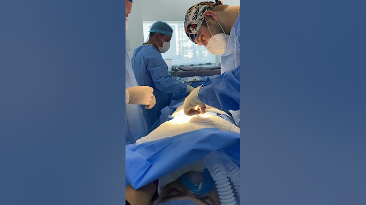 Corrección de Hernia Umbilical