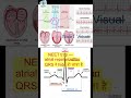 ECG Explained in 60 Sec 🔥 Heart Graph Trick | NEET Biology