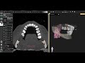 AI Dental Segmentation in DICOM Vision: TotalSegmentator + ToothFairy Demo #3