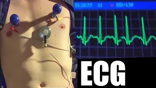 Fast heartbeat sound and ECG monitor Resimi
