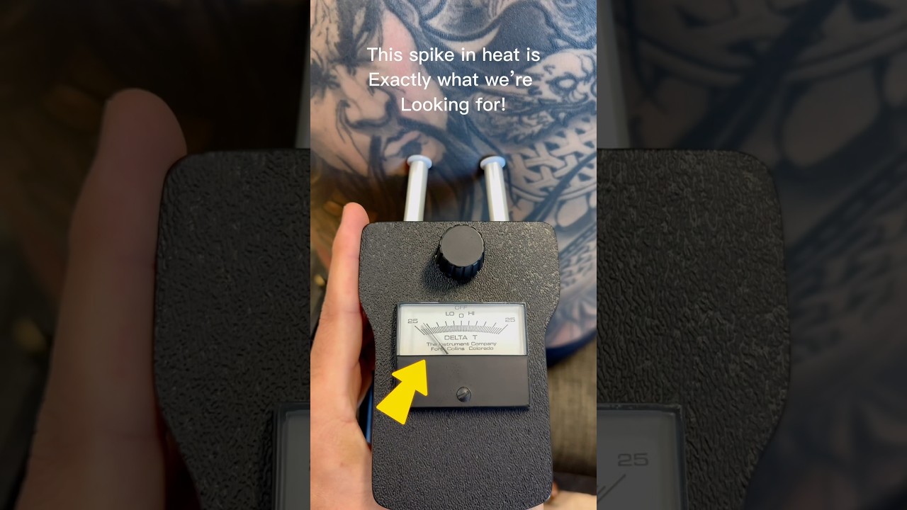 Meet the Nervoscope! 