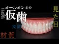 歯を抜いた後はどうなる？オールオン4の仮歯について ナルト先生