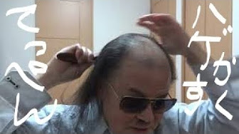 てっぺんハゲを自毛で隠す Hide The Bald With Your Own Hair Youtube