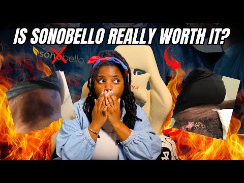 Cheap Lipo Is Ruining People’s Lives 🫣|sono Bello Horror Stories