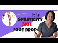 Walking after stroke: Spasticity versus foot drop