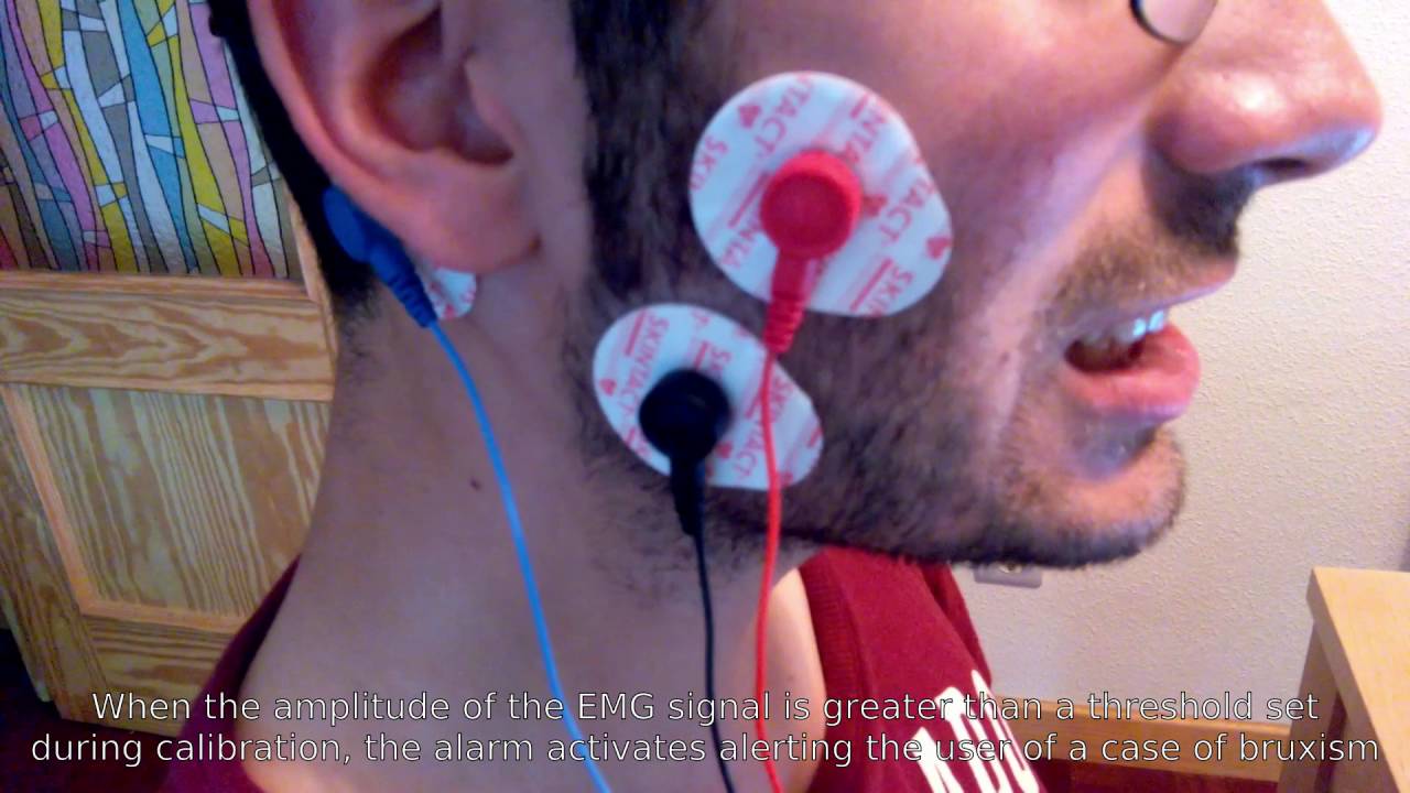 Bruxism alarm using EMG YouTube