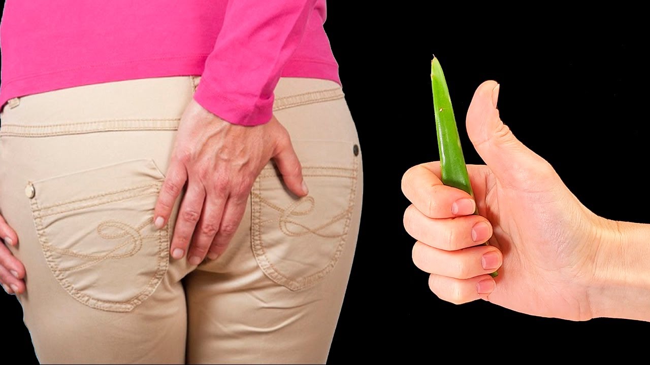 It KILLS Hemorrhoids Without Surgery! Cure Swollen Hemorrhoids Grandma
