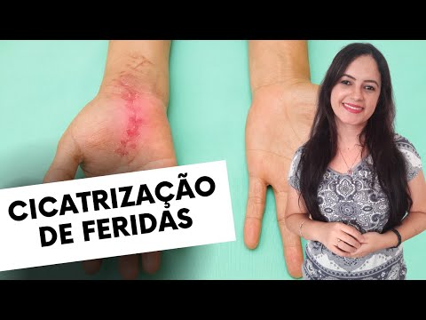 Vídeo: Como medir a pressão arterial sem ferramentas: 13 etapas (com fotos)