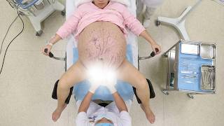 Real Natural Birth Vlog || Water Breaking, From Labor Pain to First Breath | NATURAL BIRTH