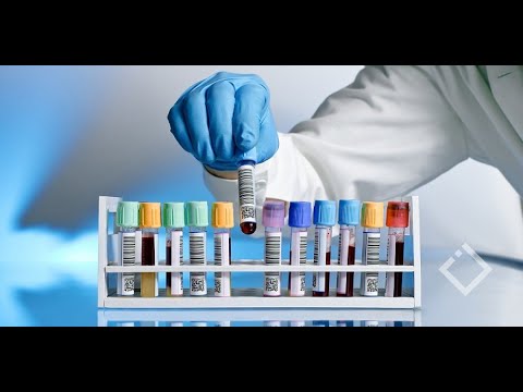 საქართველოში კორონავირუსით დაინფიცირებულთა რიცხვი გაიზარდა